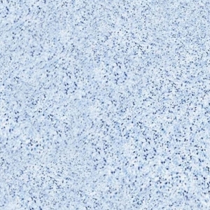 Пленка ПВХ Aquaviva Terrazzo 1,65x25,2м (мраморная крошка) - wod-mir.ru 